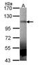 Muscle Associated Receptor Tyrosine Kinase antibody, GTX102521, GeneTex, Western Blot image 