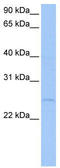 Ribosomal RNA-processing protein 7 homolog A antibody, TA343833, Origene, Western Blot image 