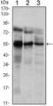 ETS Variant 5 antibody, GTX82825, GeneTex, Western Blot image 