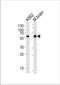 BAI1 Associated Protein 2 antibody, TA324869, Origene, Western Blot image 