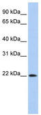 Deoxyribonuclease 2 Beta antibody, TA329461, Origene, Western Blot image 