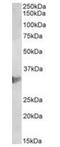 Chloride Intracellular Channel 1 antibody, orb176710, Biorbyt, Western Blot image 