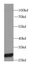 Prx-III antibody, FNab06838, FineTest, Western Blot image 