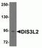 DIS3 Like 3'-5' Exoribonuclease 2 antibody, NBP2-81805, Novus Biologicals, Western Blot image 