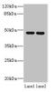 Zinc Finger DHHC-Type Containing 6 antibody, orb357687, Biorbyt, Western Blot image 