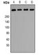 Phosphoinositide Kinase, FYVE-Type Zinc Finger Containing antibody, orb382537, Biorbyt, Western Blot image 
