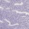 Acid Phosphatase, Prostate antibody, HPA063916, Atlas Antibodies, Immunohistochemistry frozen image 