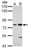 Cadherin-6 antibody, GTX114313, GeneTex, Western Blot image 