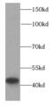 HLA class I histocompatibility antigen, Cw-12 alpha chain antibody, FNab03898, FineTest, Western Blot image 