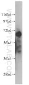 Rho GTPase-activating protein 15 antibody, 11940-1-AP, Proteintech Group, Western Blot image 