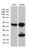 Acyl-CoA Dehydrogenase Medium Chain antibody, LS-C792933, Lifespan Biosciences, Western Blot image 