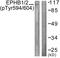 EPHB1 antibody, LS-C198924, Lifespan Biosciences, Western Blot image 