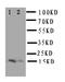 Fatty Acid Binding Protein 5 antibody, LS-C312991, Lifespan Biosciences, Western Blot image 