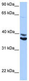 MyoD Family Inhibitor Domain Containing antibody, TA339839, Origene, Western Blot image 