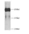 Dicer 1, Ribonuclease III antibody, FNab02387, FineTest, Western Blot image 