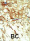 Ret Proto-Oncogene antibody, abx033599, Abbexa, Immunohistochemistry paraffin image 