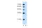Phospholipid Phosphatase 1 antibody, 29-703, ProSci, Enzyme Linked Immunosorbent Assay image 