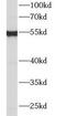 Interferon Induced Protein With Tetratricopeptide Repeats 2 antibody, FNab04137, FineTest, Western Blot image 