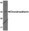 Chondroadherin antibody, 8421, ProSci Inc, Western Blot image 