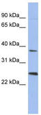 MAGE Family Member B2 antibody, TA337656, Origene, Western Blot image 