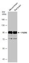 Discs Large MAGUK Scaffold Protein 4 antibody, GTX133255, GeneTex, Western Blot image 
