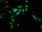 RAB35, Member RAS Oncogene Family antibody, LS-C377376, Lifespan Biosciences, Immunofluorescence image 