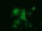 Aldehyde Dehydrogenase 1 Family Member L1 antibody, GTX84894, GeneTex, Immunocytochemistry image 