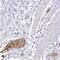 Erythrocyte Membrane Protein Band 4.2 antibody, NBP1-82762, Novus Biologicals, Immunohistochemistry frozen image 