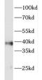 Forkhead Box R2 antibody, FNab03213, FineTest, Western Blot image 