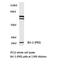 BCL2 antibody, LS-C176387, Lifespan Biosciences, Western Blot image 