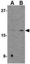 Cerebral dopamine neurotrophic factor antibody, GTX85432, GeneTex, Western Blot image 