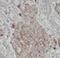 Matrix Metallopeptidase 16 antibody, FNab10494, FineTest, Immunohistochemistry frozen image 