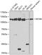 DNA replication licensing factor MCM6 antibody, GTX54353, GeneTex, Western Blot image 