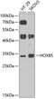 Homeobox protein Hox-B5 antibody, 23-415, ProSci, Western Blot image 