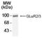 Metabotropic Glutamate Receptor 2 & 3 antibody, NB300-302, Novus Biologicals, Western Blot image 