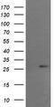 RCAN Family Member 3 antibody, M11135, Boster Biological Technology, Western Blot image 