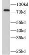 Spleen Associated Tyrosine Kinase antibody, FNab08414, FineTest, Western Blot image 