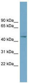 EGF Containing Fibulin Extracellular Matrix Protein 2 antibody, TA333774, Origene, Western Blot image 