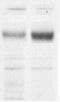 Corin, Serine Peptidase antibody, TA354723, Origene, Western Blot image 