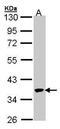 PCIF1 antibody, PA5-28522, Invitrogen Antibodies, Western Blot image 