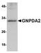 Glucosamine-6-Phosphate Deaminase 2 antibody, TA306736, Origene, Western Blot image 