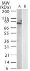 TLR11 antibody, MA1-41484, Invitrogen Antibodies, Western Blot image 