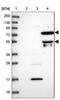 Heparanase 2 (Inactive) antibody, NBP1-93691, Novus Biologicals, Western Blot image 