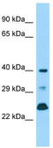 Dual Specificity Phosphatase 11 antibody, TA345841, Origene, Western Blot image 