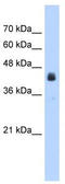 Ubiquitin carboxyl-terminal hydrolase 16 antibody, TA338905, Origene, Western Blot image 