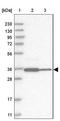 Coiled-Coil Domain Containing 181 antibody, NBP1-93899, Novus Biologicals, Western Blot image 