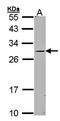 Guanylate Cyclase 2C antibody, orb73636, Biorbyt, Western Blot image 