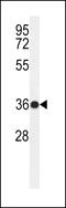 Par-6 Family Cell Polarity Regulator Gamma antibody, 61-647, ProSci, Western Blot image 