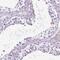 Family With Sequence Similarity 81 Member B antibody, PA5-64476, Invitrogen Antibodies, Immunohistochemistry paraffin image 