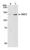 Structural maintenance of chromosomes protein 2 antibody, NB100-372, Novus Biologicals, Western Blot image 